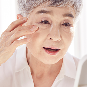 퇴행성 변화